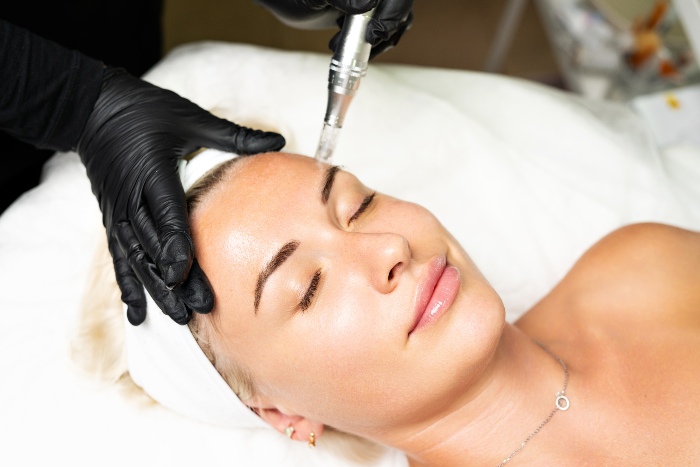 Microneedling Services in Burke, VA