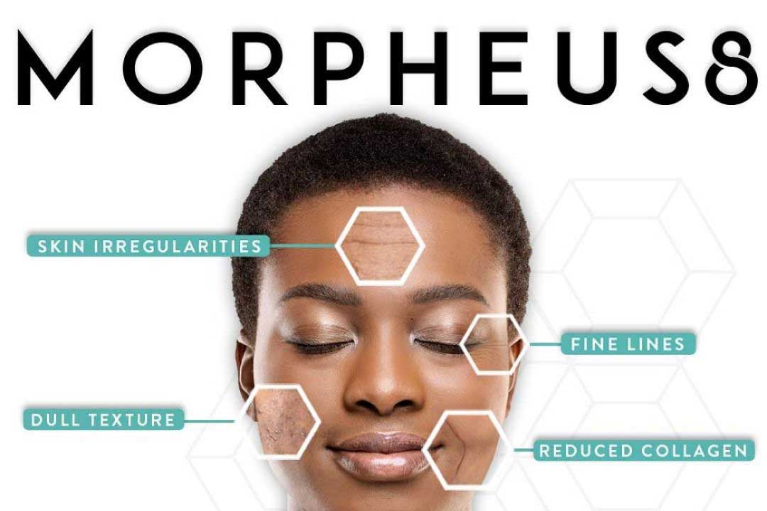 Ingredients of Morpheus 8: Retinol, hyaluronic acid, peptides, vitamin C, and collagen. A powerful blend for rejuvenating and firming the skin