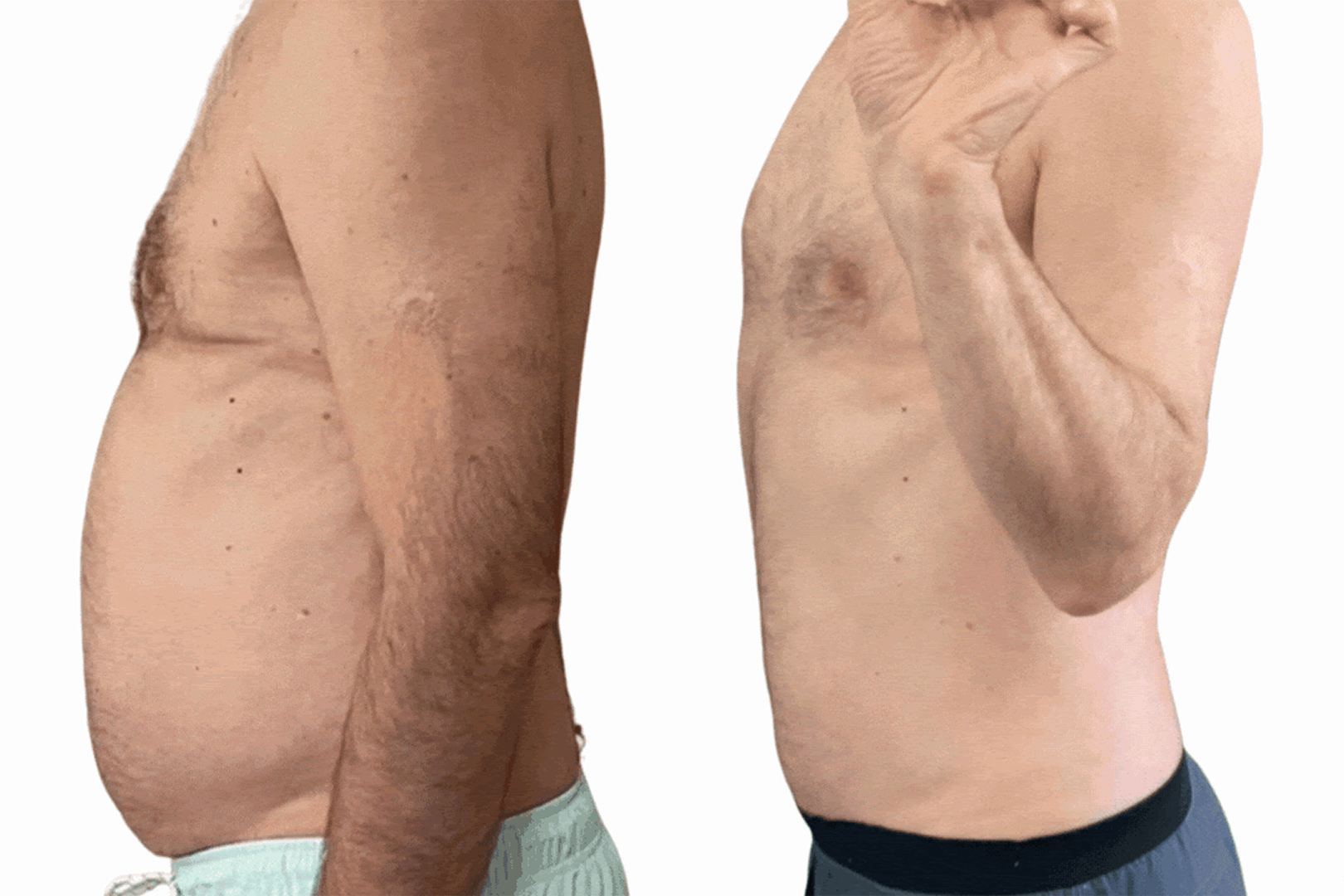 Before & After - The Proof